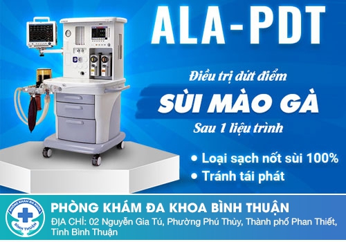 ĐIỀU TRỊ SÙI MÀO GÀ BẰNG CÔNG NGHỆ ALA - PDT