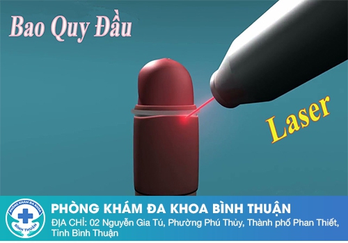 Phương pháp cắt bao quy đầu bằng laser
