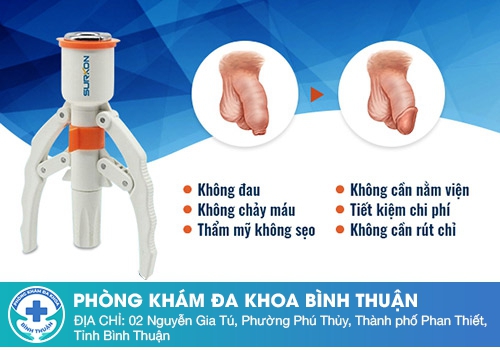 phương pháp cắt bao quy đầu bằng công nghệ Châu Âu