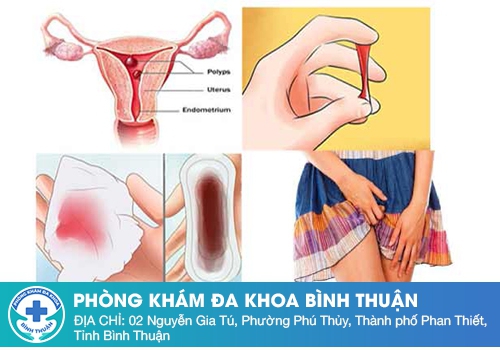 Chảy máu âm đạo nhưng không phải kinh nguyệt là do đâu?