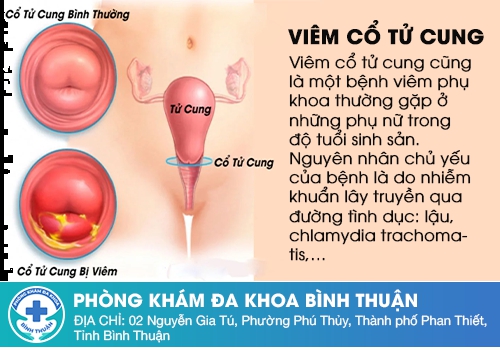 Huyết trắng màu hồng nguyên nhân do đâu?